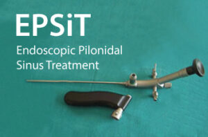 EPSIT: Endoscopic Pilonidal Sinus Treatment